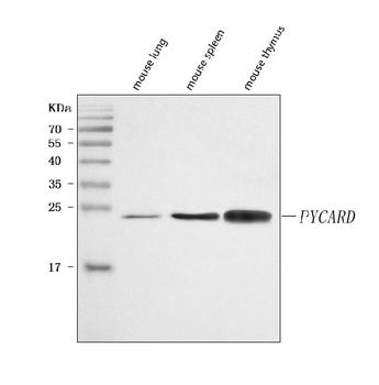 ASC/TMS1/Pycard Rabbit Polyclonal Antibody