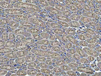 Renin/REN Rabbit Polyclonal Antibody