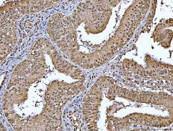 RBM15 Rabbit Polyclonal Antibody