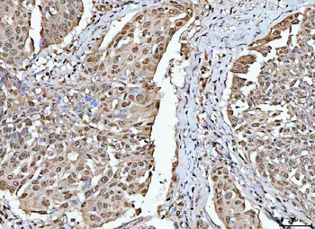 RBM15 Rabbit Polyclonal Antibody