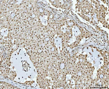 RBM15 Rabbit Polyclonal Antibody