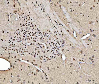 RBM15 Rabbit Polyclonal Antibody