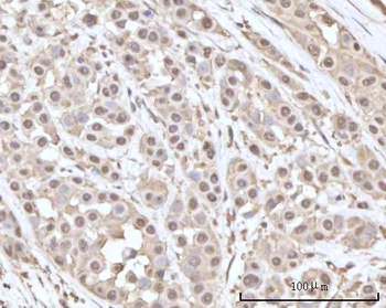 Recoverin/RCVRN Rabbit Polyclonal Antibody