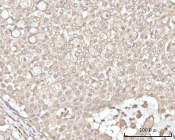 Recoverin/RCVRN Rabbit Polyclonal Antibody