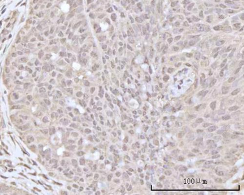 Recoverin/RCVRN Rabbit Polyclonal Antibody