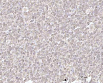 Recoverin/RCVRN Rabbit Polyclonal Antibody