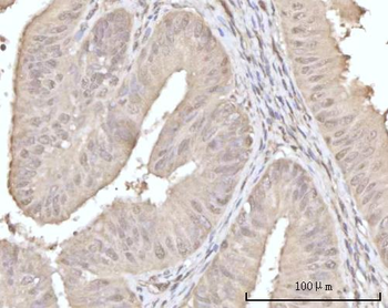 Recoverin/RCVRN Rabbit Polyclonal Antibody
