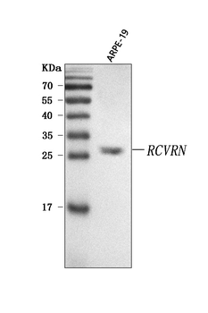 Recoverin/RCVRN Rabbit Polyclonal Antibody