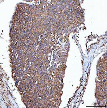 PGP Rabbit Polyclonal Antibody