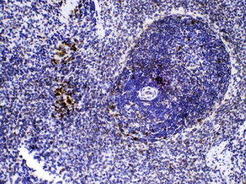 Caspase 8/CASP8 Rabbit Polyclonal Antibody