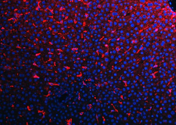 F4/80/Adgre1 Rabbit Polyclonal Antibody