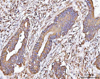 MICALL2 Rabbit Polyclonal Antibody