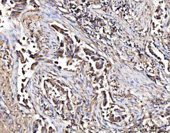 MARK3 Rabbit Polyclonal Antibody