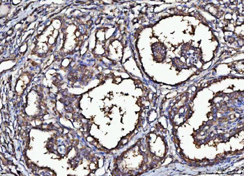 MARK3 Rabbit Polyclonal Antibody