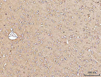 MARK3 Rabbit Polyclonal Antibody