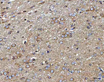 MARK3 Rabbit Polyclonal Antibody