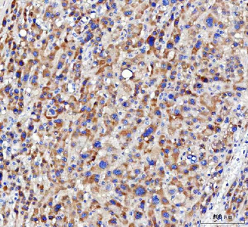 NUDT6 Rabbit Polyclonal Antibody