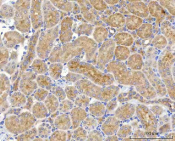 NUDT6 Rabbit Polyclonal Antibody
