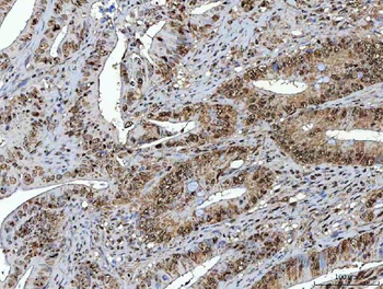 NSUN2 Rabbit Polyclonal Antibody