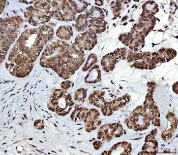 NSUN2 Rabbit Polyclonal Antibody