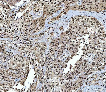 NSUN2 Rabbit Polyclonal Antibody