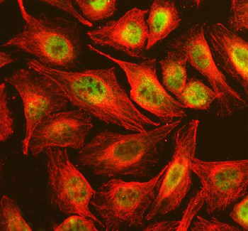 NSMCE2 Rabbit Polyclonal Antibody