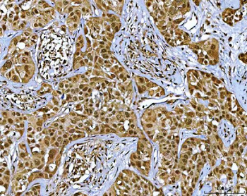 NR5A2 Rabbit Polyclonal Antibody