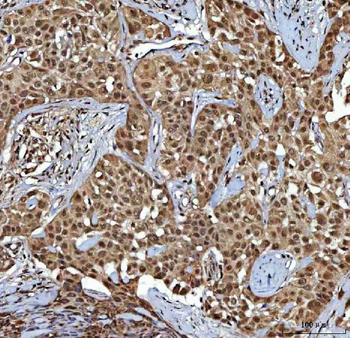 NR2C2 Rabbit Polyclonal Antibody