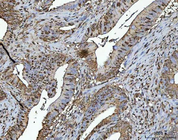NR2C2 Rabbit Polyclonal Antibody