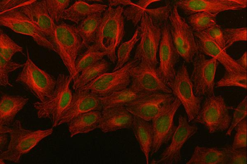 MED26 Rabbit Polyclonal Antibody