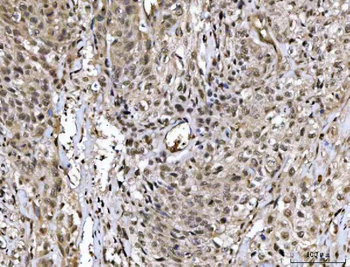 MED26 Rabbit Polyclonal Antibody