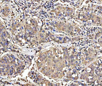MED26 Rabbit Polyclonal Antibody