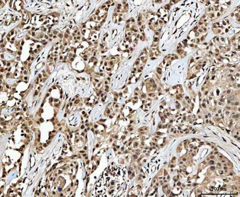 MED26 Rabbit Polyclonal Antibody