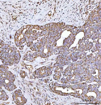 MECR Rabbit Polyclonal Antibody