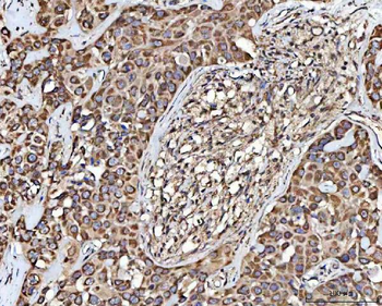 MECR Rabbit Polyclonal Antibody