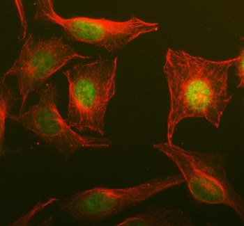 NOSIP Rabbit Polyclonal Antibody