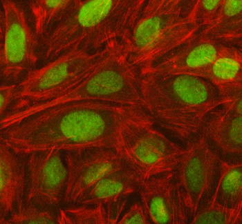 NOSIP Rabbit Polyclonal Antibody