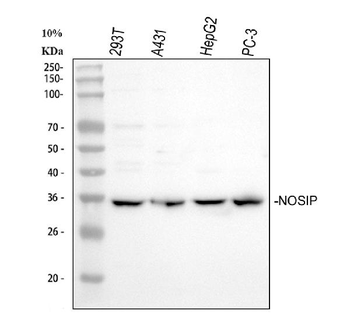 NOSIP Rabbit Polyclonal Antibody