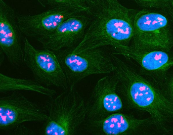 NOP2 Rabbit Polyclonal Antibody
