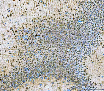 NVL Rabbit Polyclonal Antibody