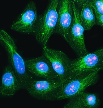 NVL Rabbit Polyclonal Antibody