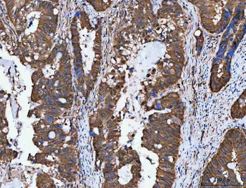 NVL Rabbit Polyclonal Antibody