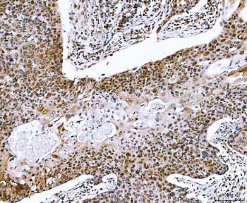NVL Rabbit Polyclonal Antibody