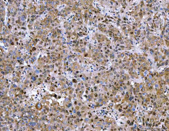 NVL Rabbit Polyclonal Antibody