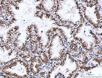 NVL Rabbit Polyclonal Antibody