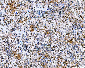 NVL Rabbit Polyclonal Antibody