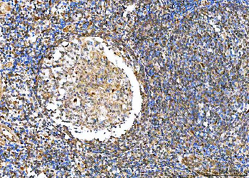 NVL Rabbit Polyclonal Antibody