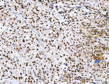 NVL Rabbit Polyclonal Antibody