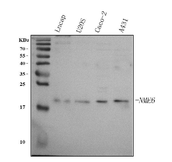NME6 Rabbit Polyclonal Antibody