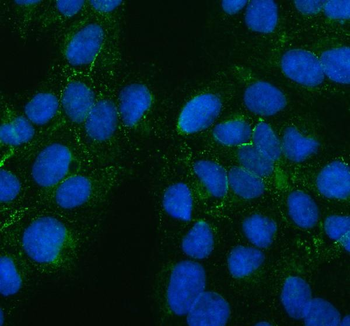 PTH2R Rabbit Polyclonal Antibody